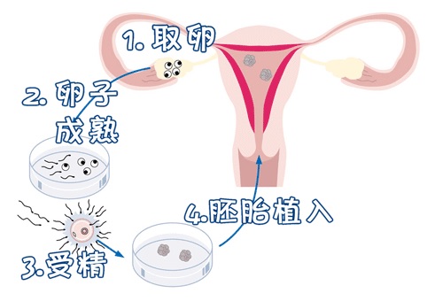 代生儿子机构生殖医学中心